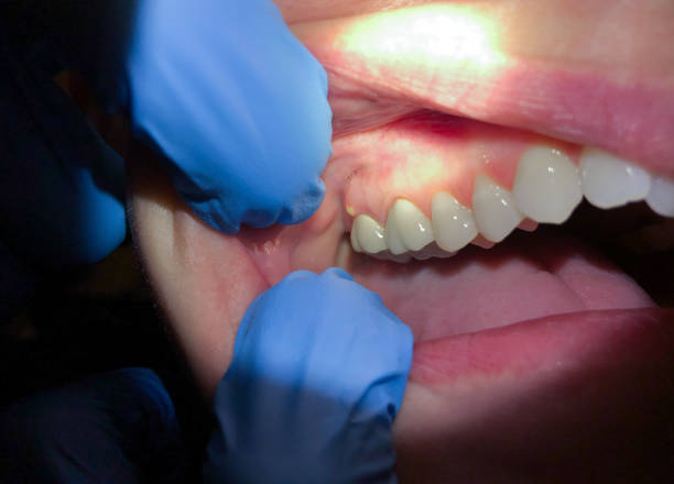 Best Emergency TMJ Treatment in Grosse Pointe Woods, MI